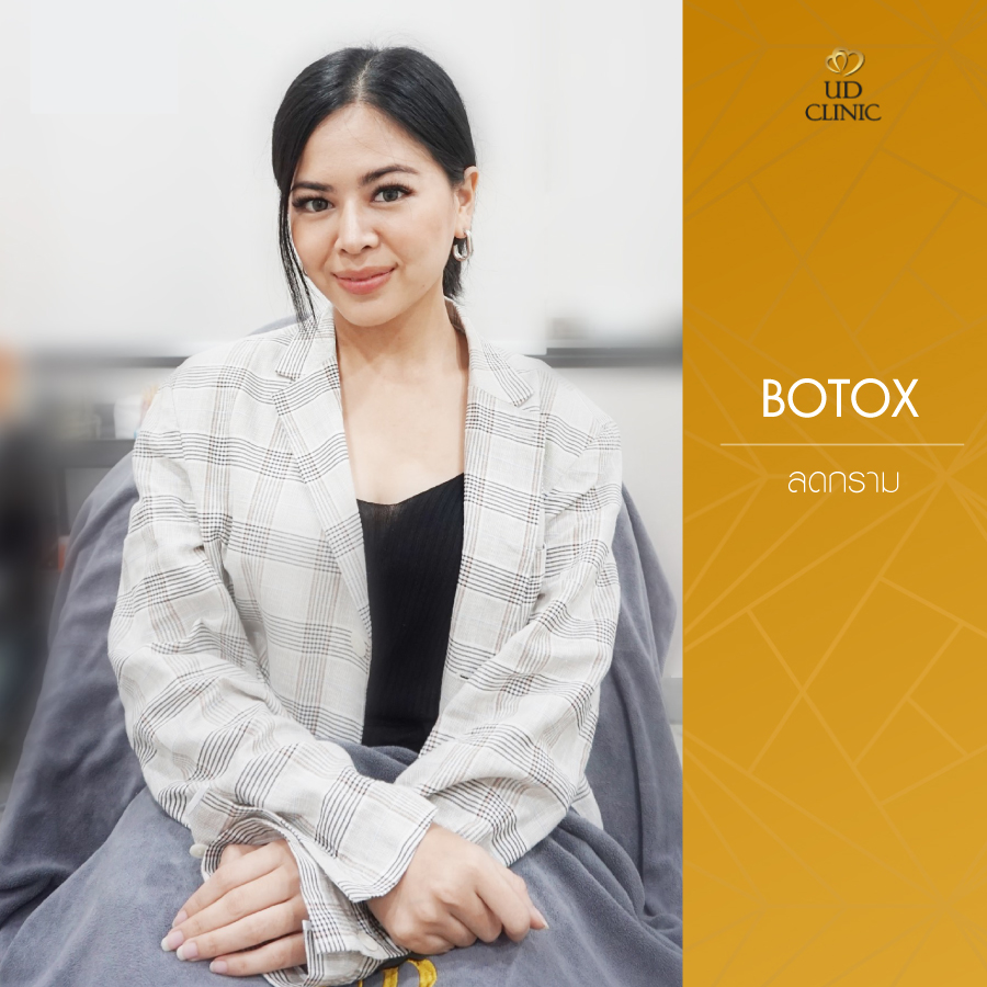 UD-Clinic-Review-Botox-5