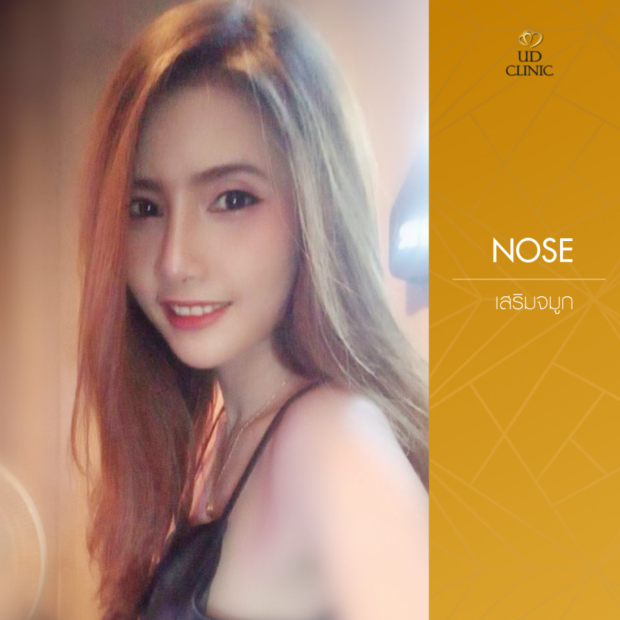 UD-Clinic-Review-Nose-21