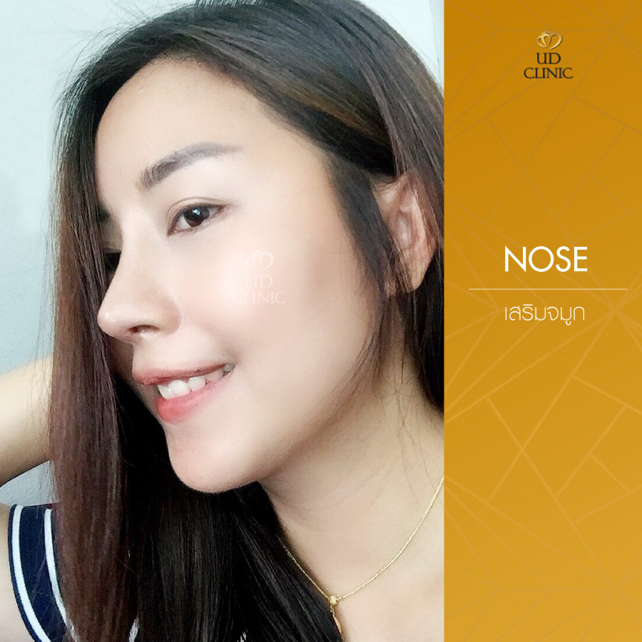 UD-Clinic-Review-Nose-27