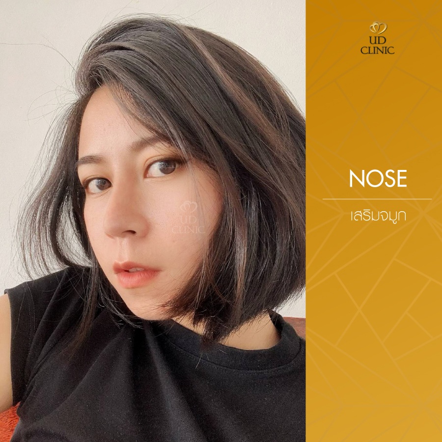 UD-Clinic-Review-Nose-32
