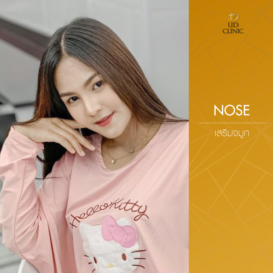 UD-Clinic-Review-Nose-38