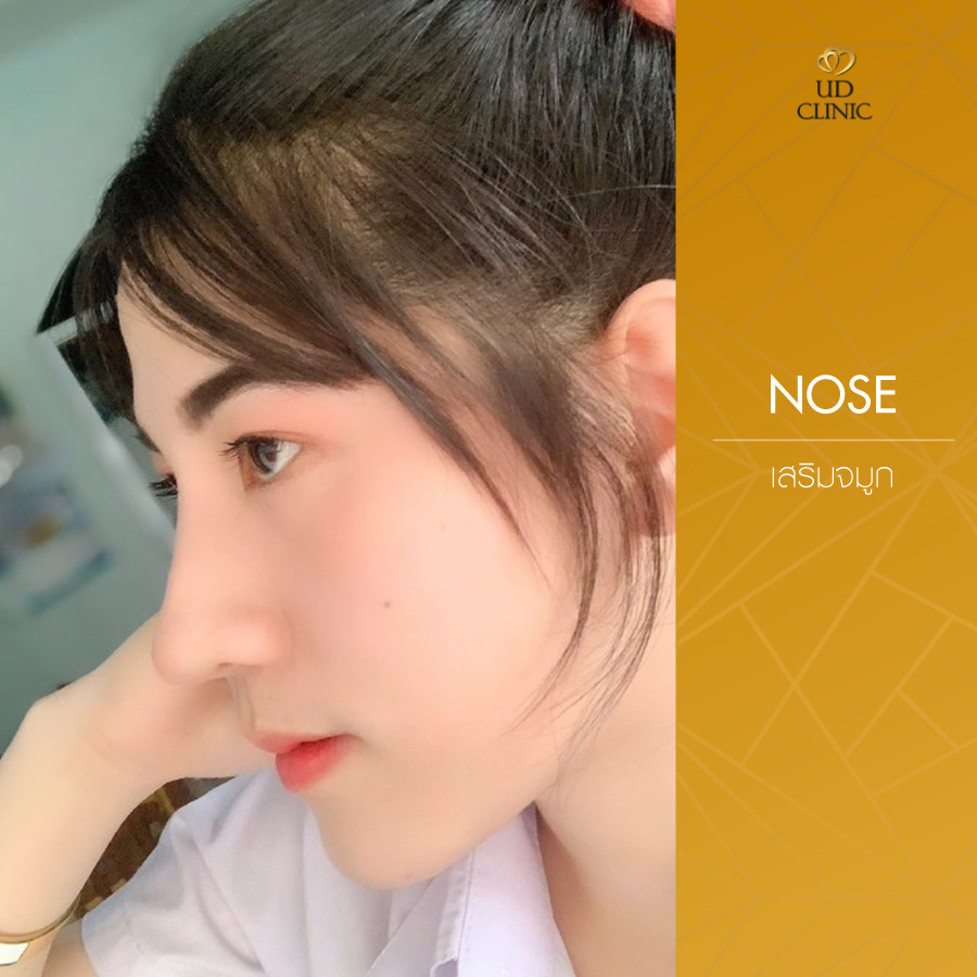UD-Clinic-Review-Nose-40