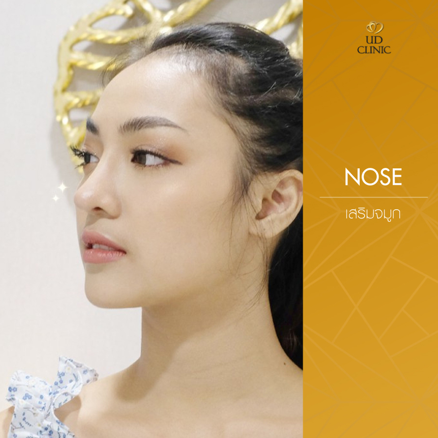 UD-Clinic-Review-Nose-41