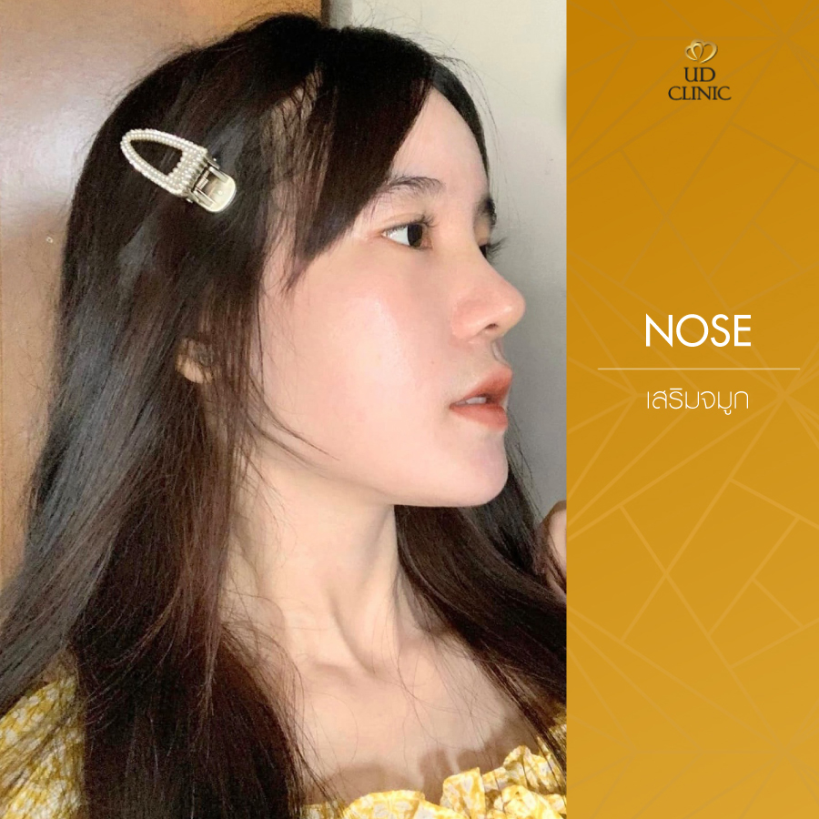 UD-Clinic-Review-Nose-42