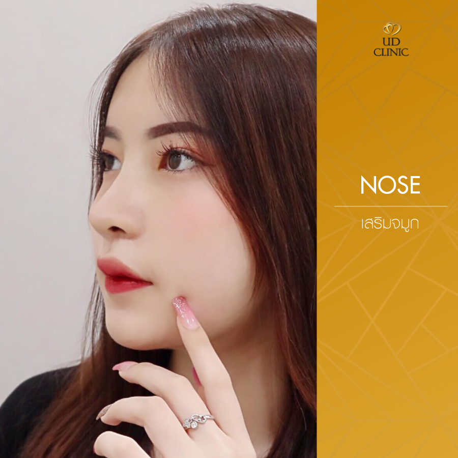 UD-Clinic-Review-Nose-45