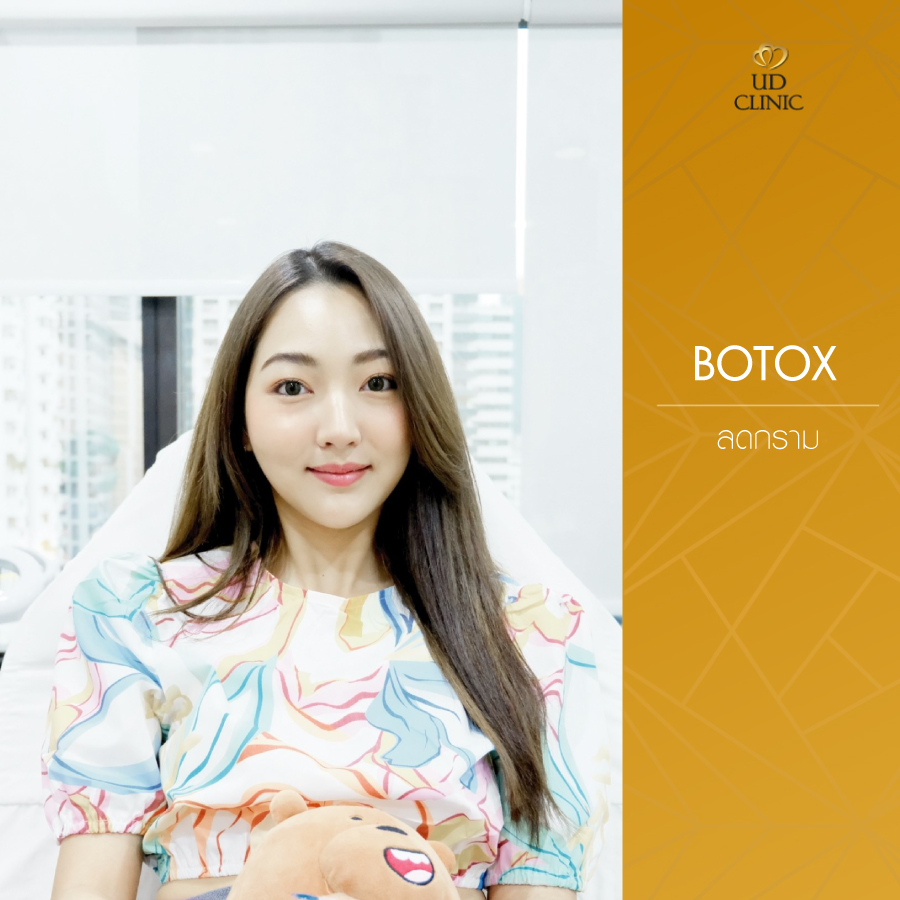 UD-Clinic-Review-Botox-16