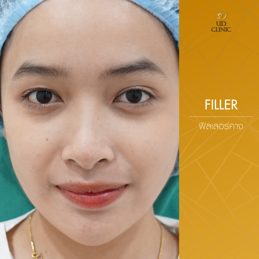 UD-Clinic-Review-Filler-8