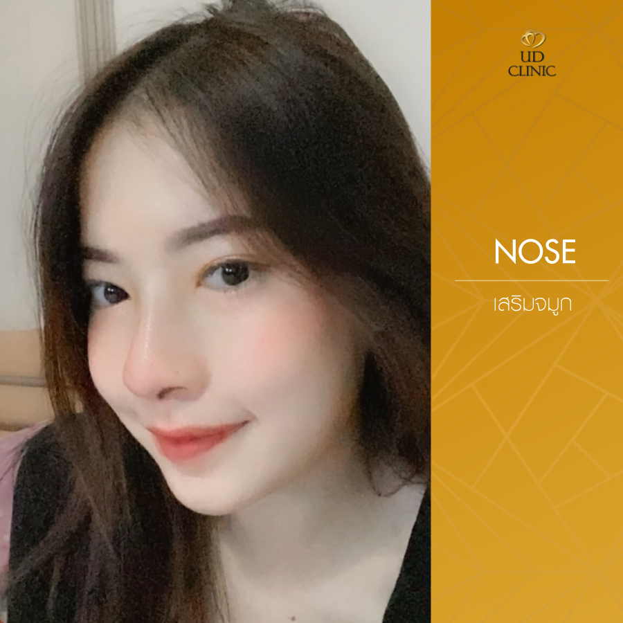 UD-Clinic-Review-Nose-52