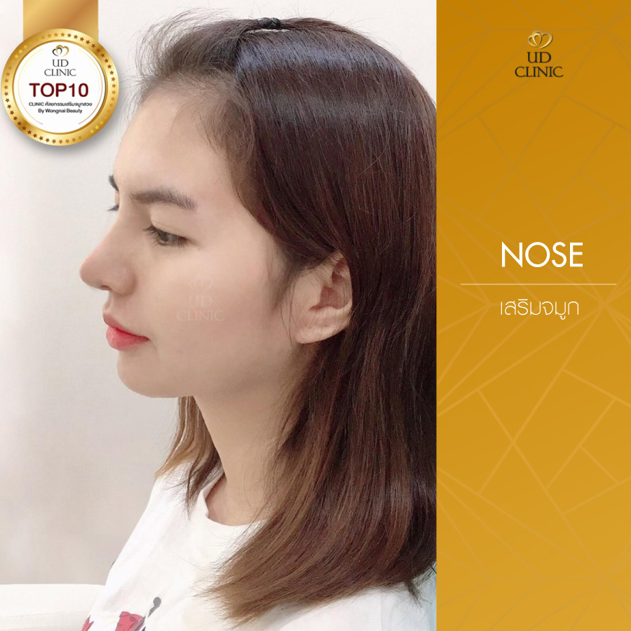 UD-Clinic-Review-Nose-53