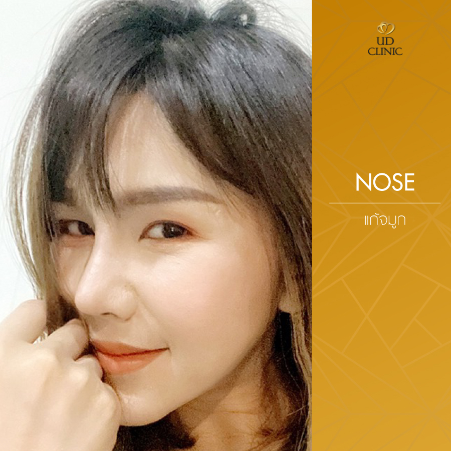 UD-Clinic-Review-Nose-56