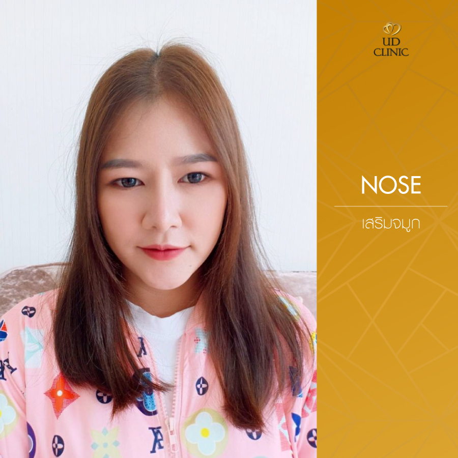 UD-Clinic-Review-Nose-59