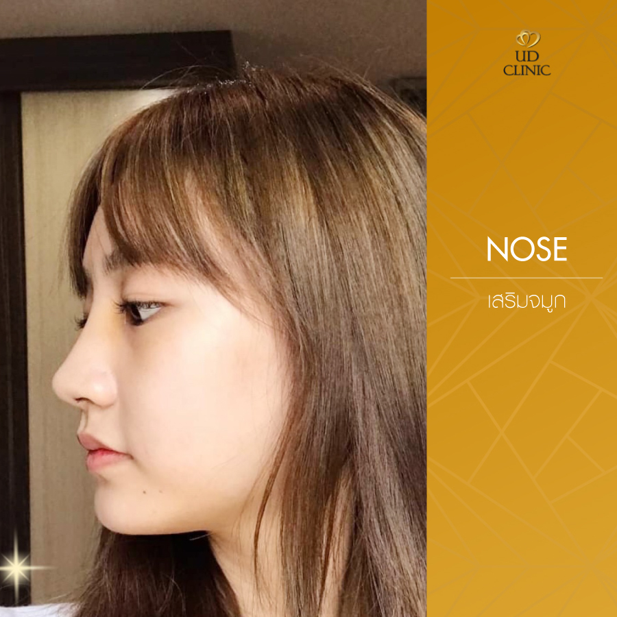UD-Clinic-Review-Nose-61