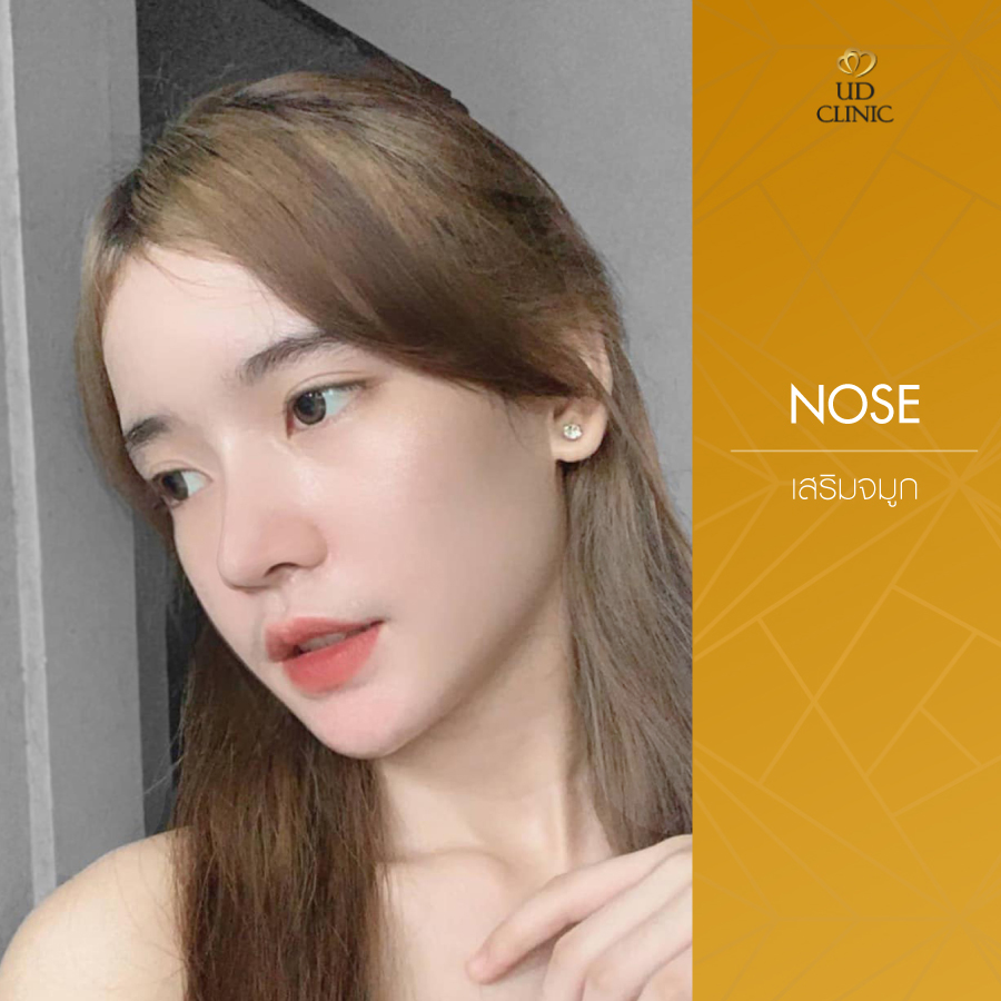 UD-Clinic-Review-Nose-63