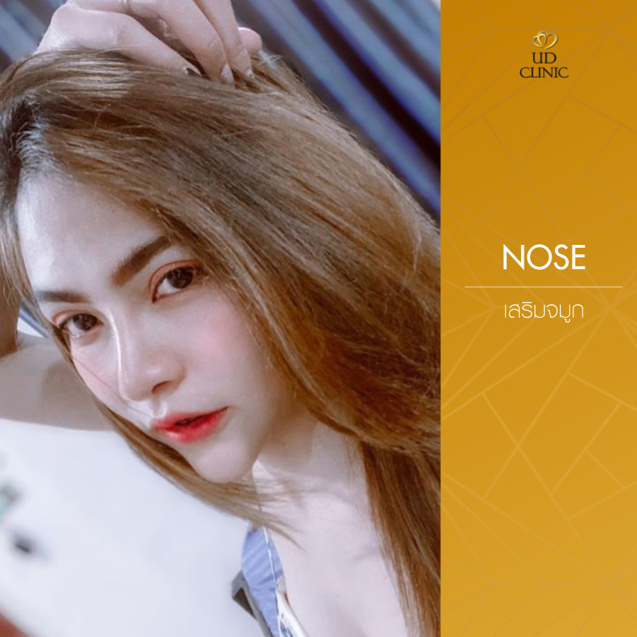 UD-Clinic-Review-Nose-66