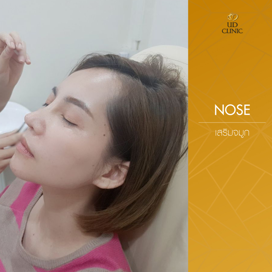 UD-Clinic-Review-Nose-67