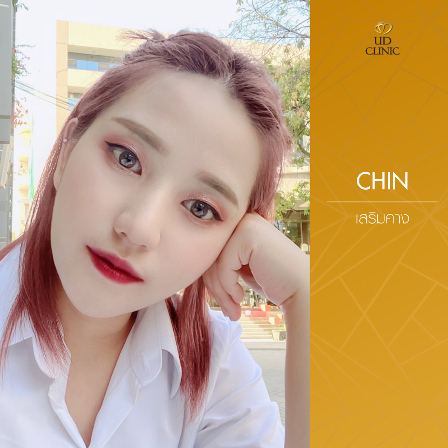 UD-Clinic-Review-Chin-15
