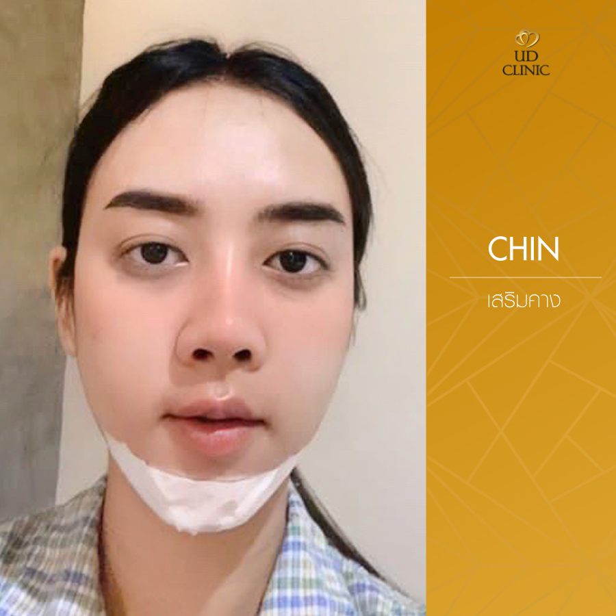 UD-Clinic-Review-Chin-16