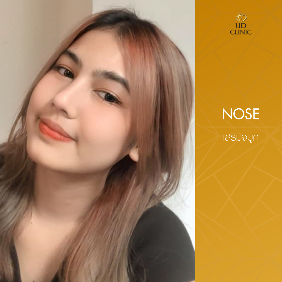 UD-Clinic-Review-Nose-72