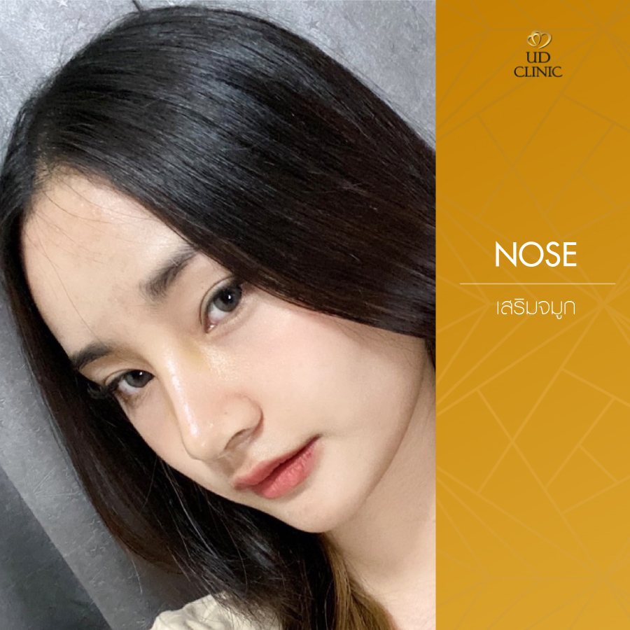 UD-Clinic-Review-Nose-82