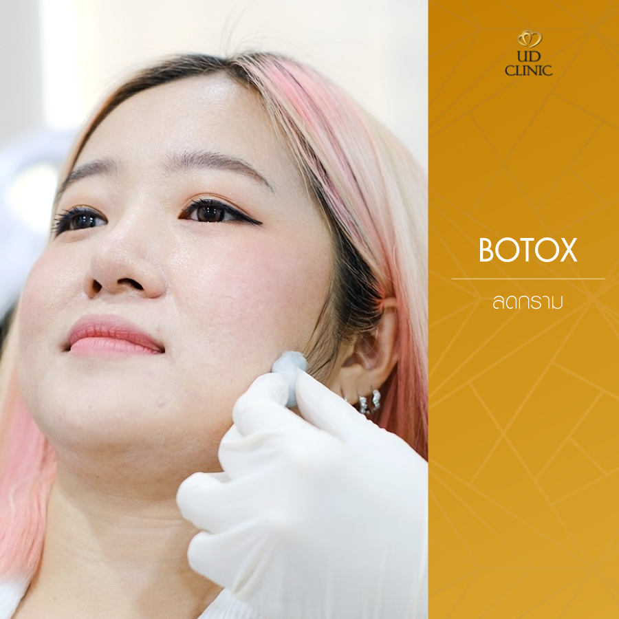 UD-Clinic-Review-Botox-20