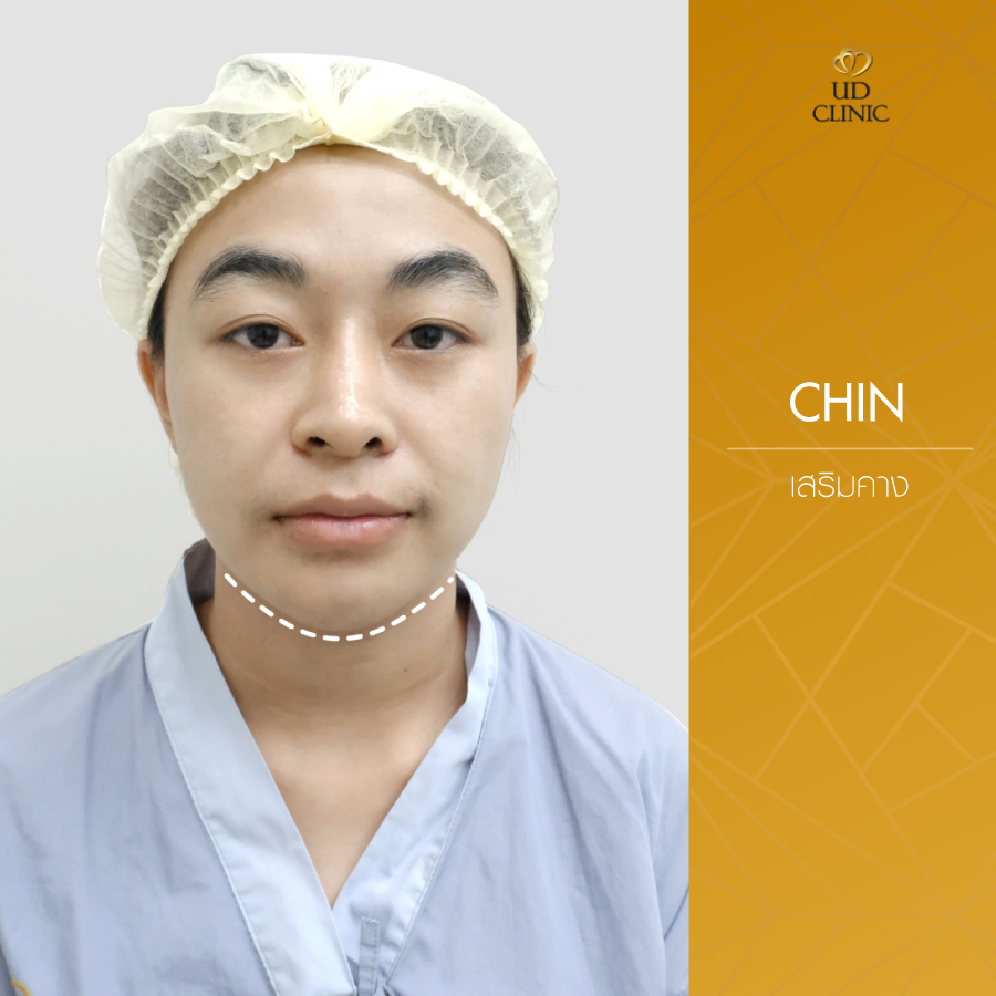 UD-Clinic-Review-Chin-18