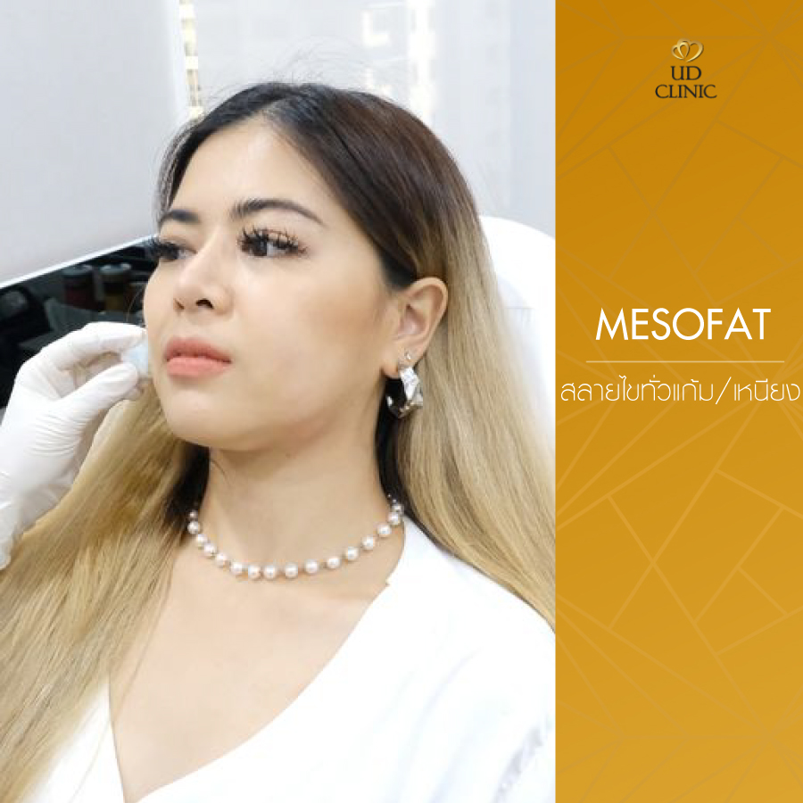 UD-Clinic-Review-Mesofat-22