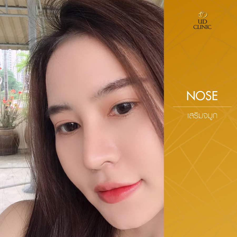 UD-Clinic-Review-Nose-95