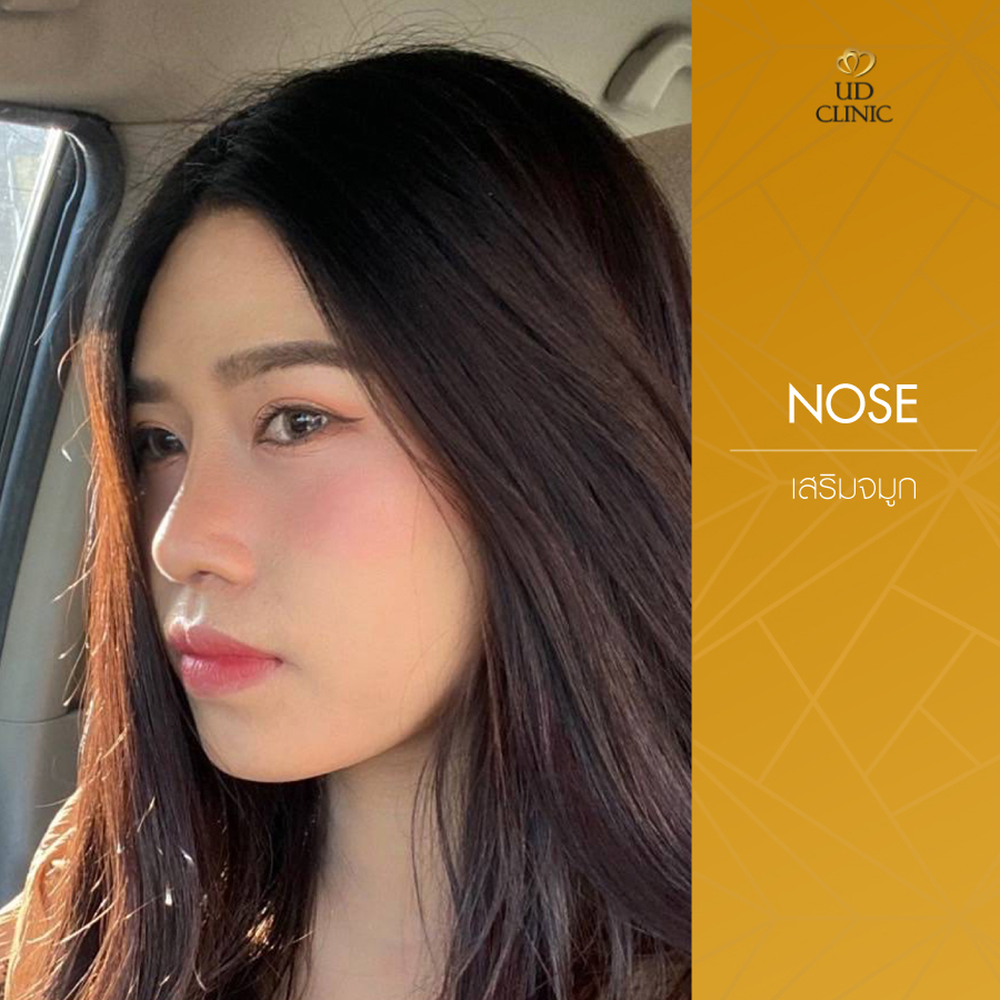 UD-Clinic-Review-Nose-99