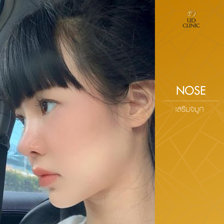 UD-Clinic-Review-Nose-102