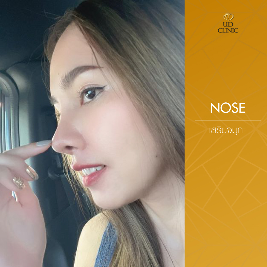 UD-Clinic-Review-Nose-105