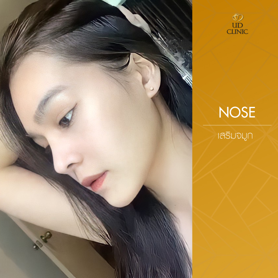 UD-Clinic-Review-Nose-106