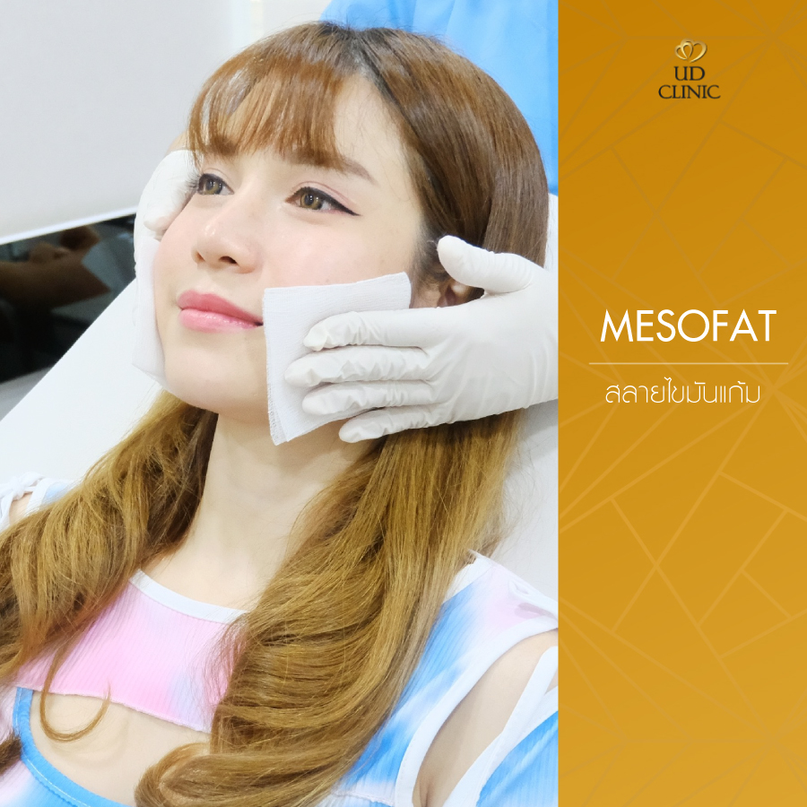UD-Clinic-Review-Mesofat-26