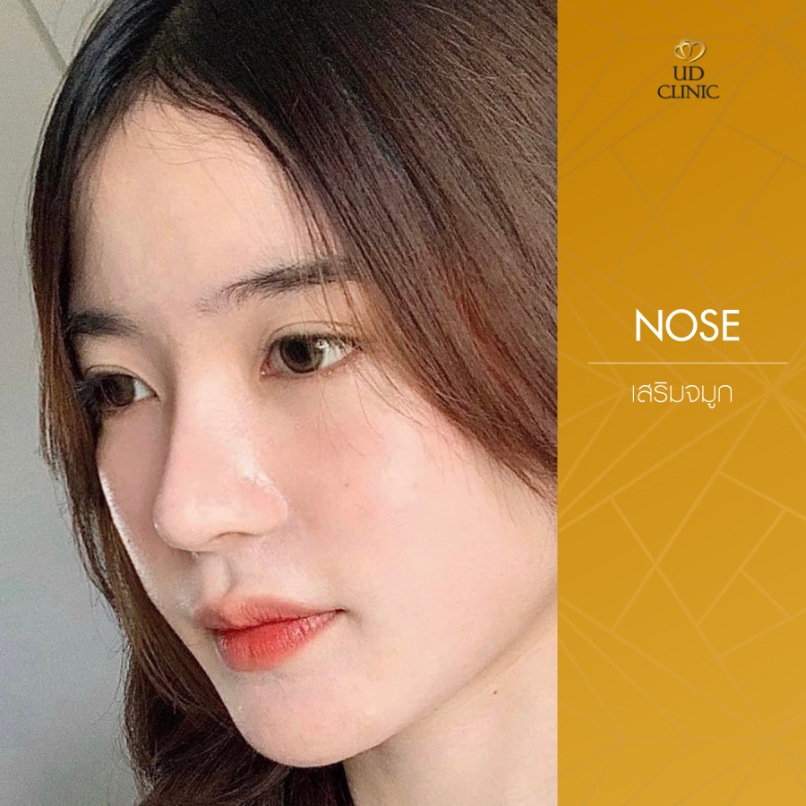 UD-Clinic-Review-Nose-107