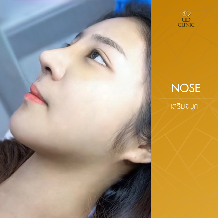 UD-Clinic-Review-Nose-108