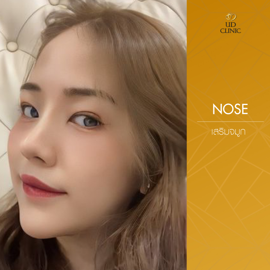 UD-Clinic-Review-Nose-110