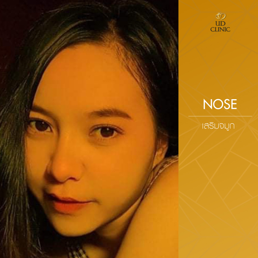 UD-Clinic-Review-Nose-111