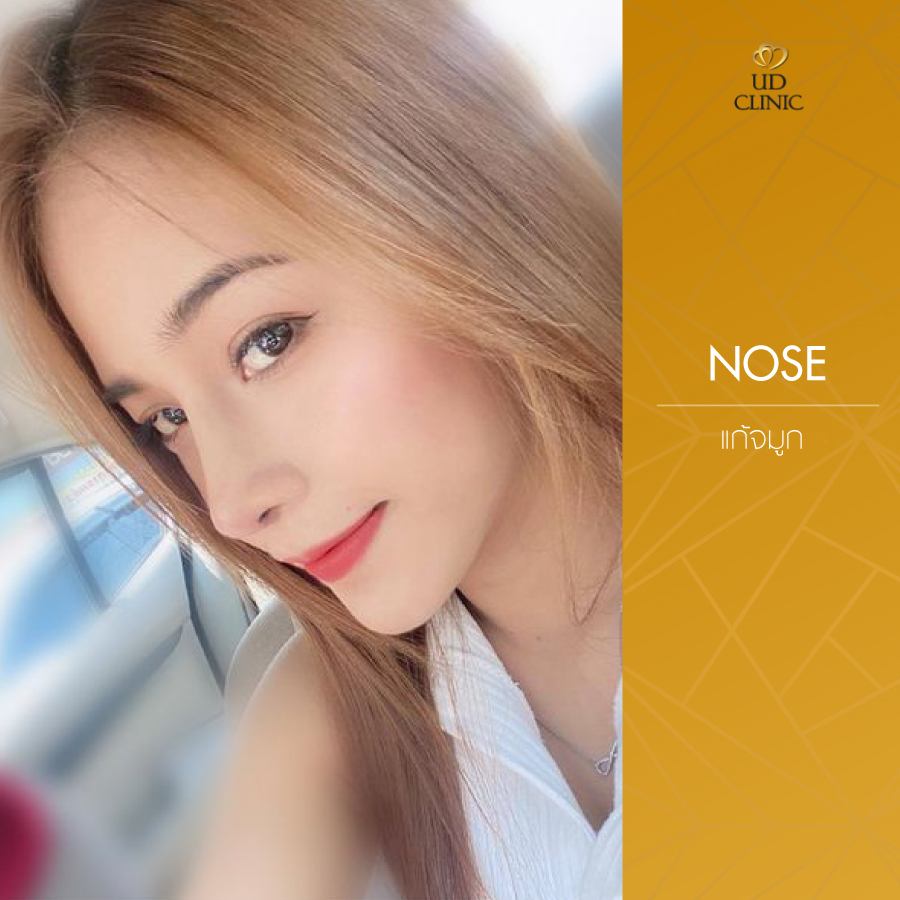 UD-Clinic-Review-Nose-112