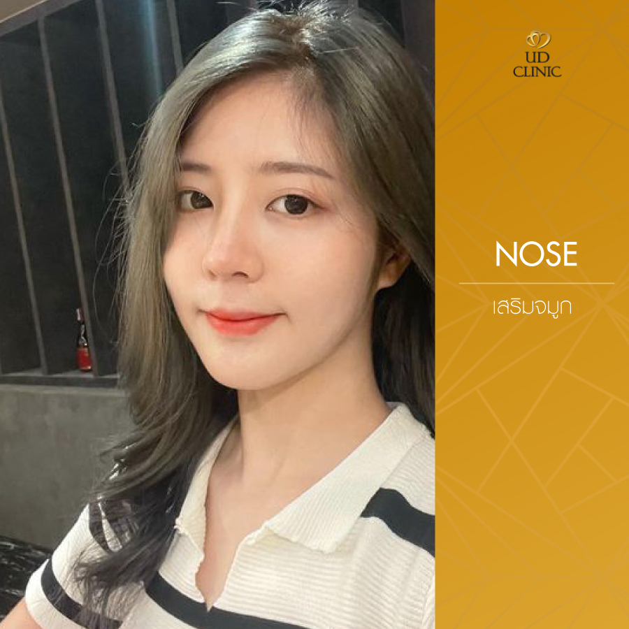 UD-Clinic-Review-Nose-113