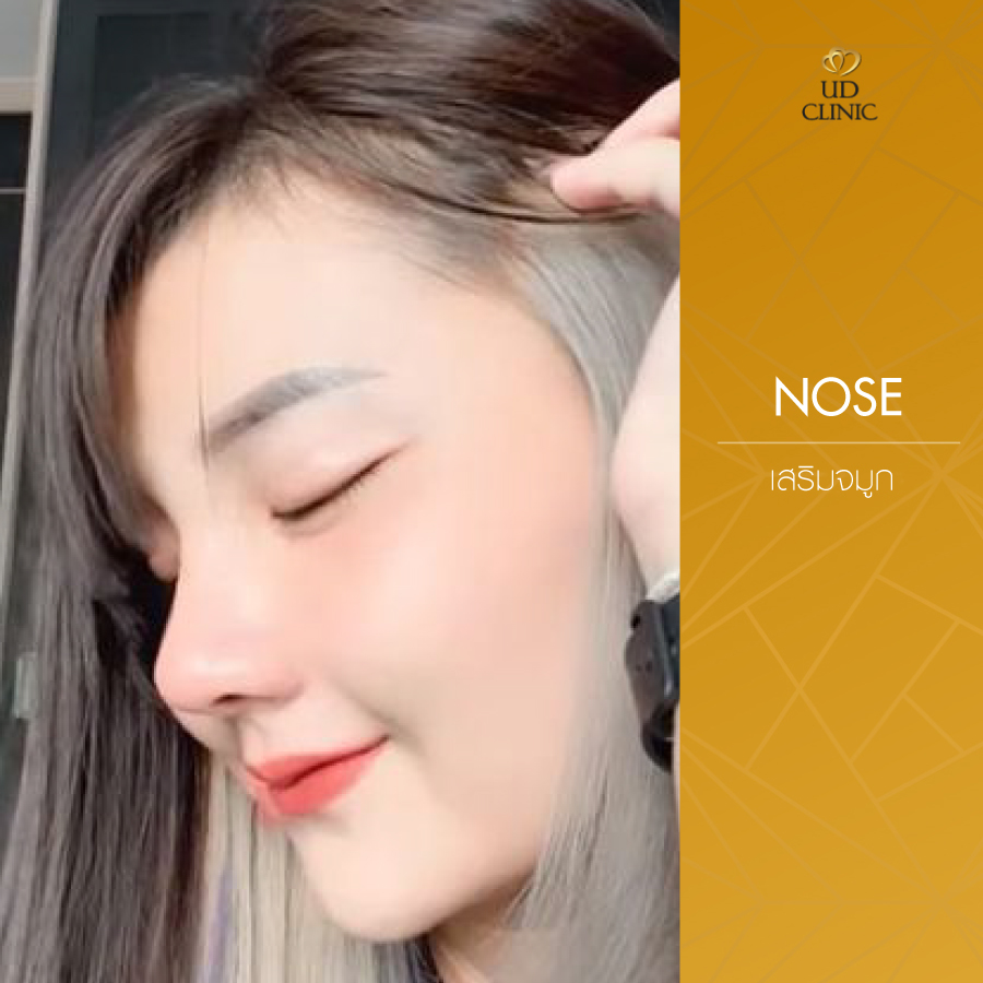 UD-Clinic-Review-Nose-114