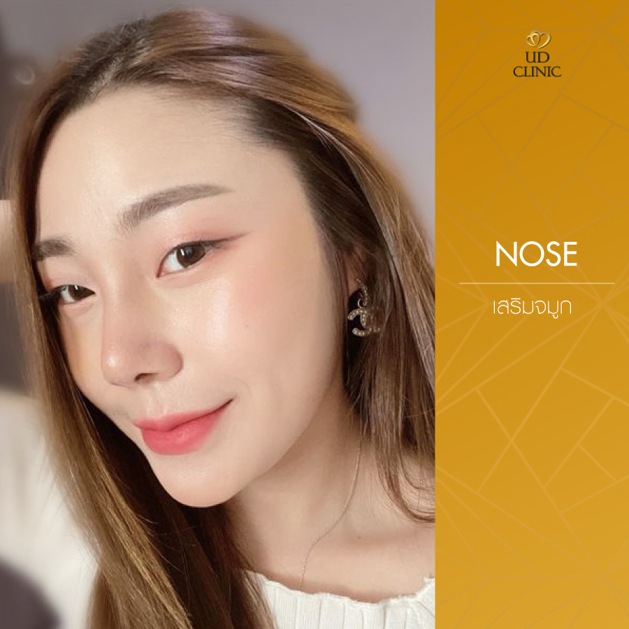 UD-Clinic-Review-Nose-115