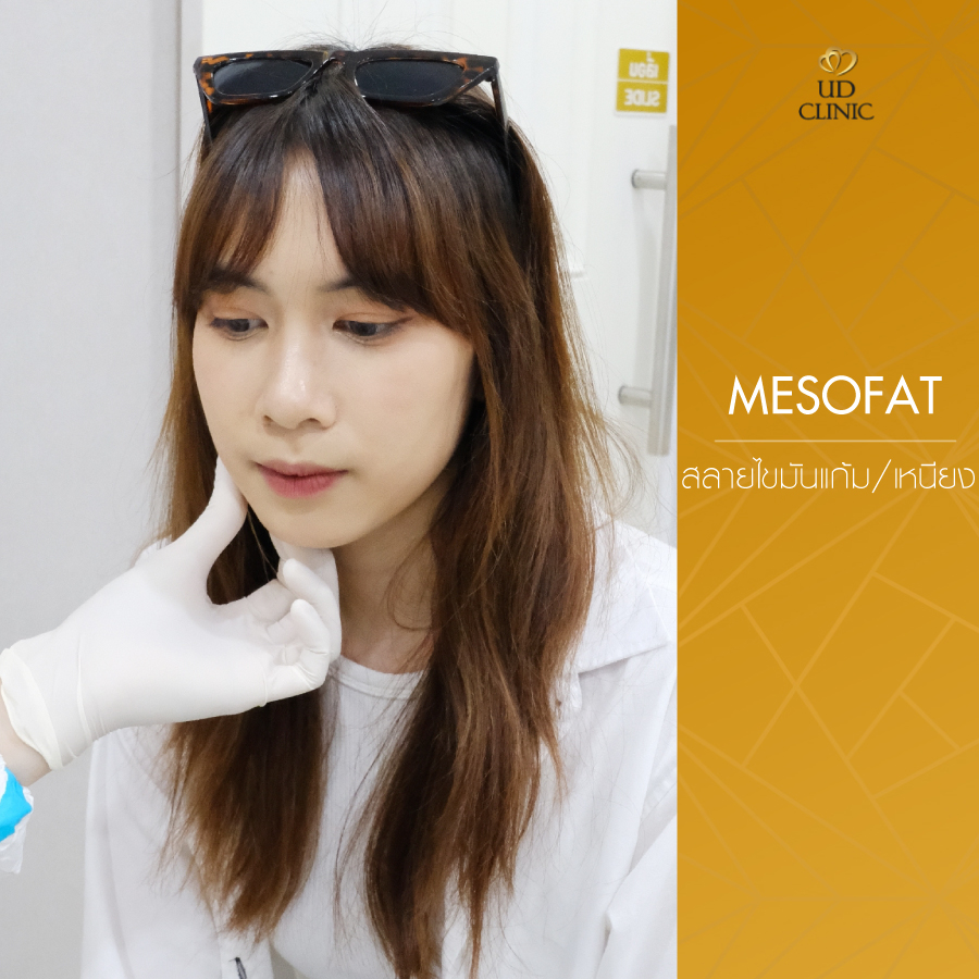 UD-Clinic-Review-Mesofat-30