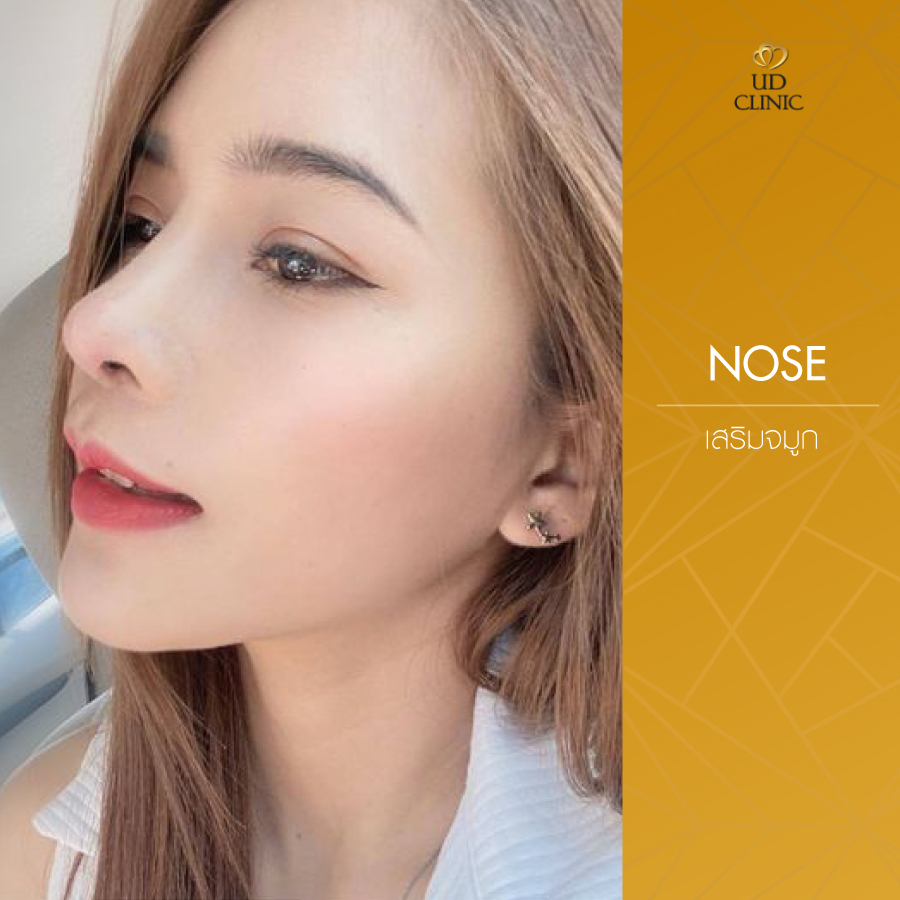 UD-Clinic-Review-Nose-117