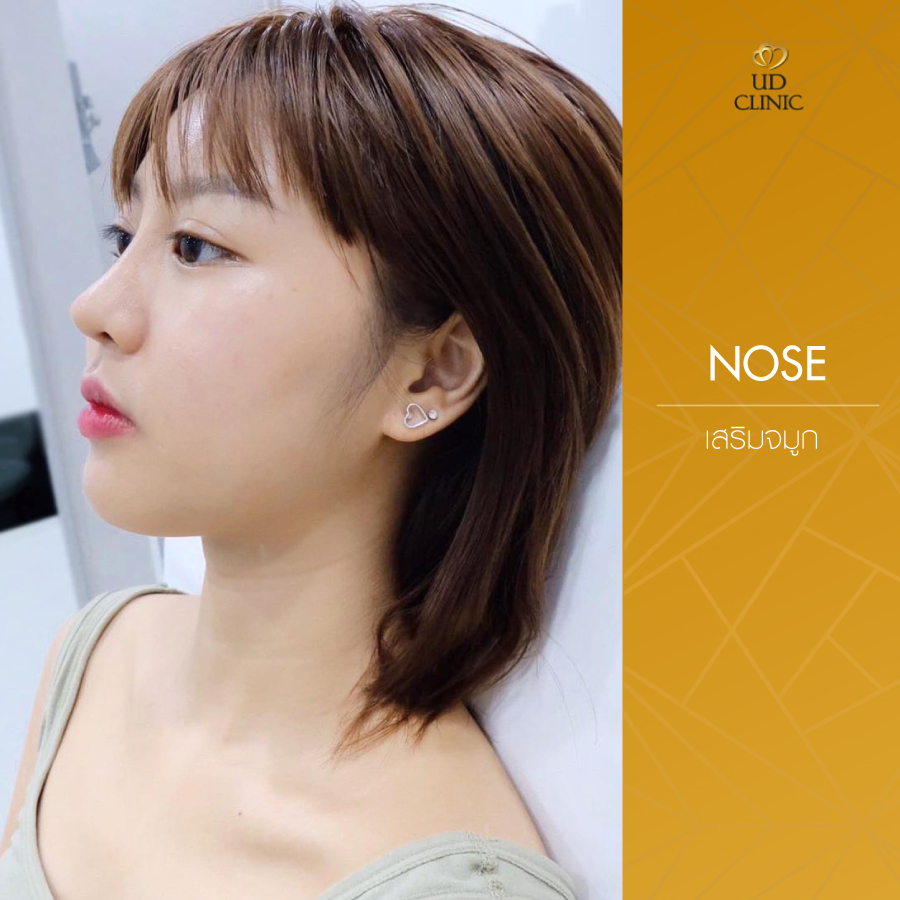UD-Clinic-Review-Nose-118