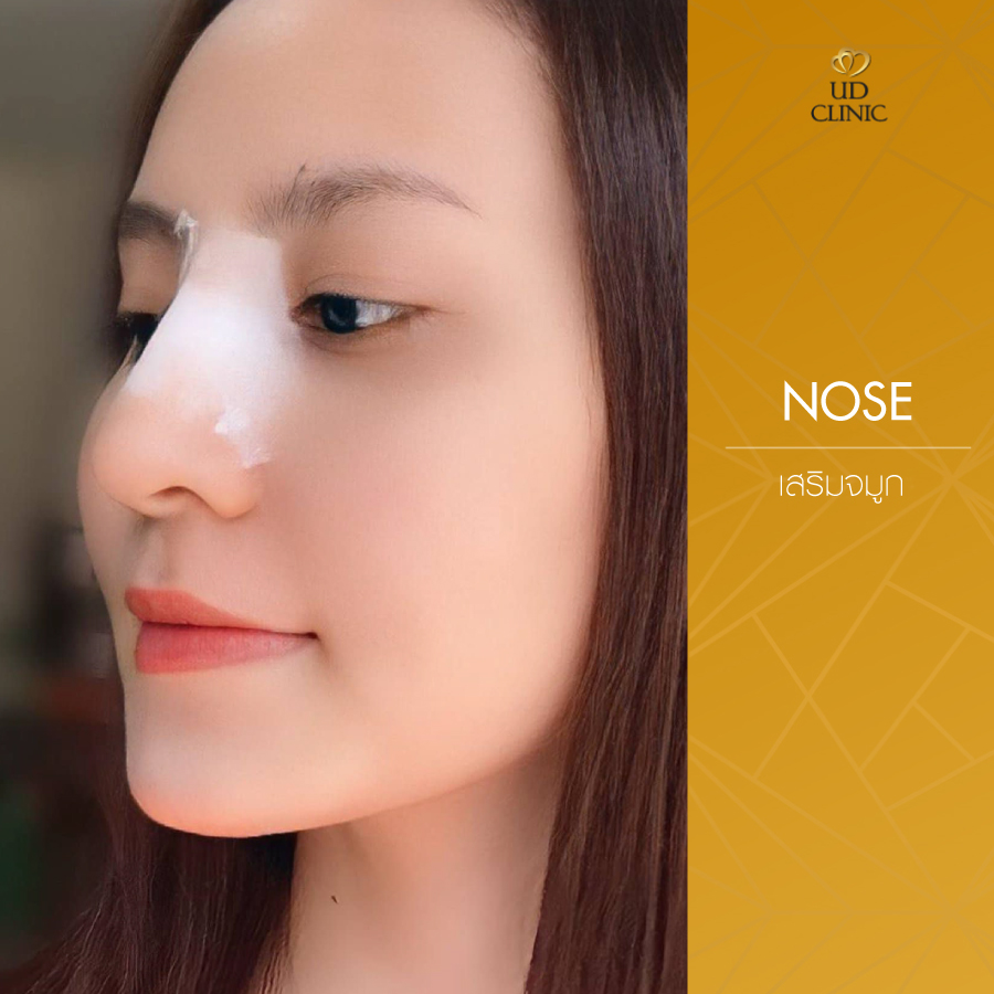 UD-Clinic-Review-Nose-119