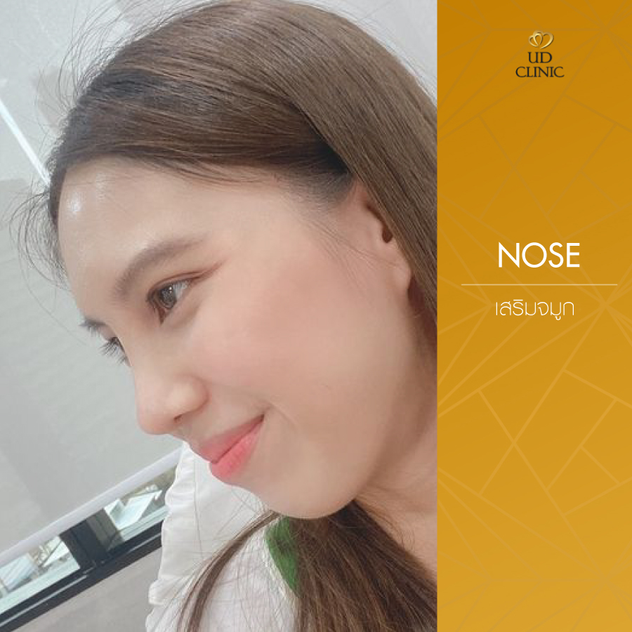 UD-Clinic-Review-Nose-120