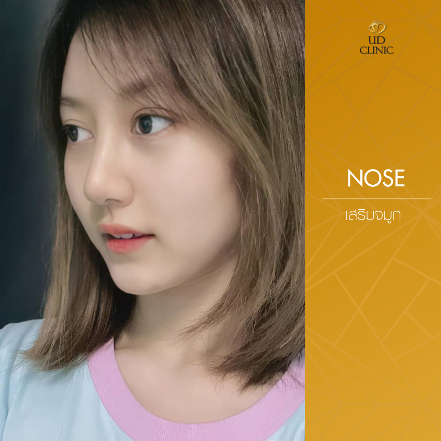 UD-Clinic-Review-Nose-121