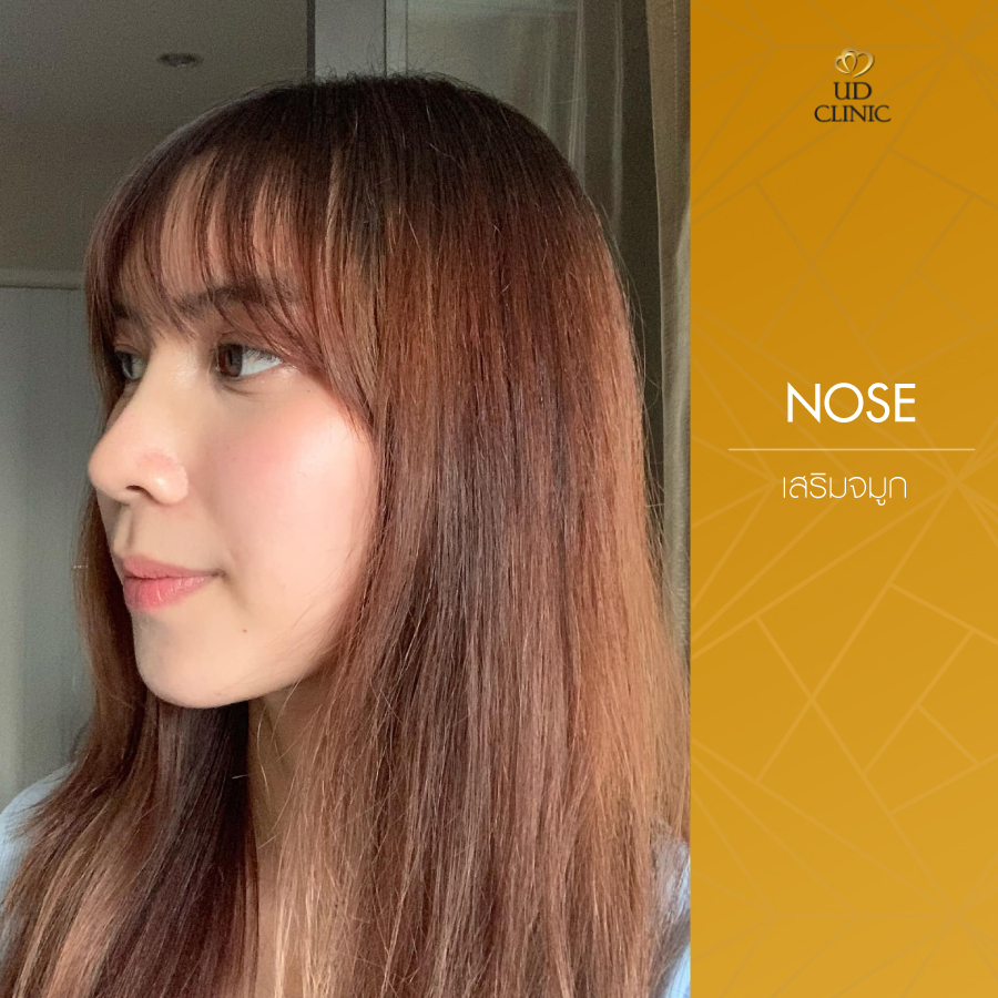 UD-Clinic-Review-Nose-123