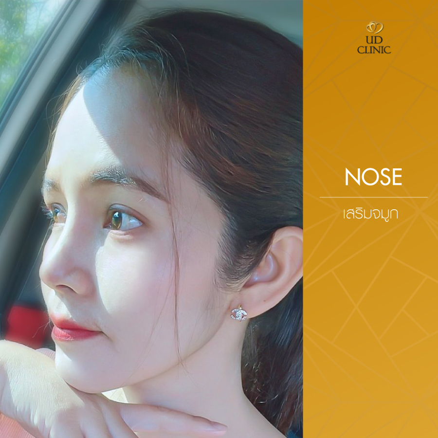 UD-Clinic-Review-Nose-124