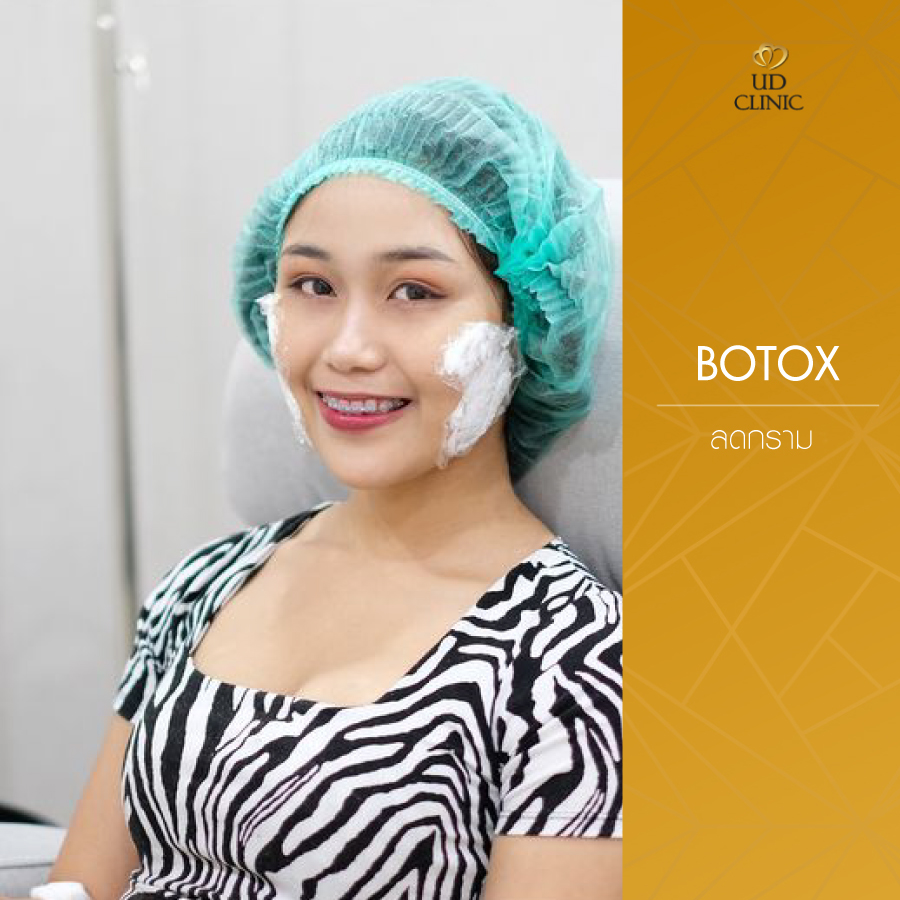 UD-Clinic-Review-Botox-23