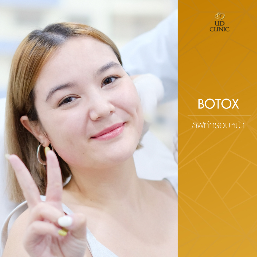 UD-Clinic-Review-Botox-24